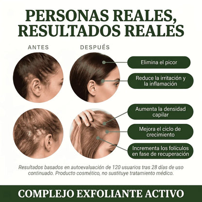 Exfoliante Natural Capilar Kuska™
