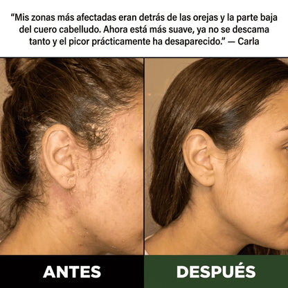 Exfoliante Natural Capilar Kuska™